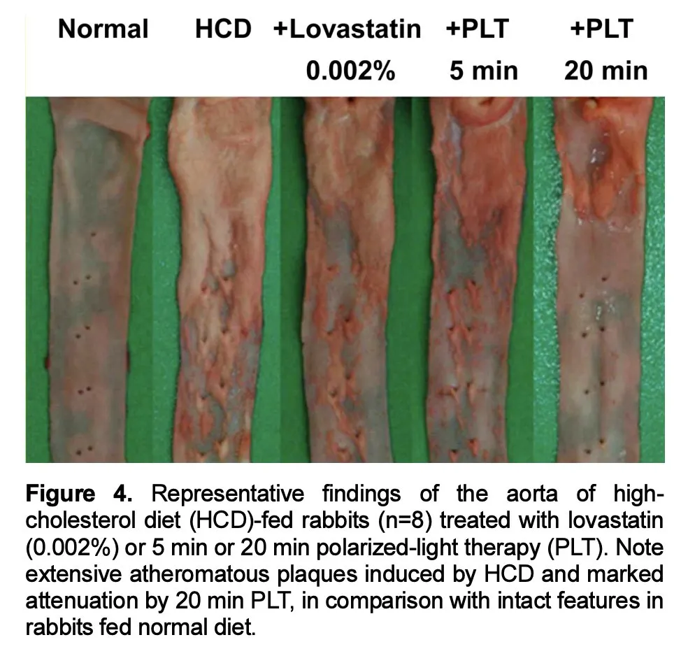 Aorta images showing plaque coverage percentages across treatment groups including red light and statins