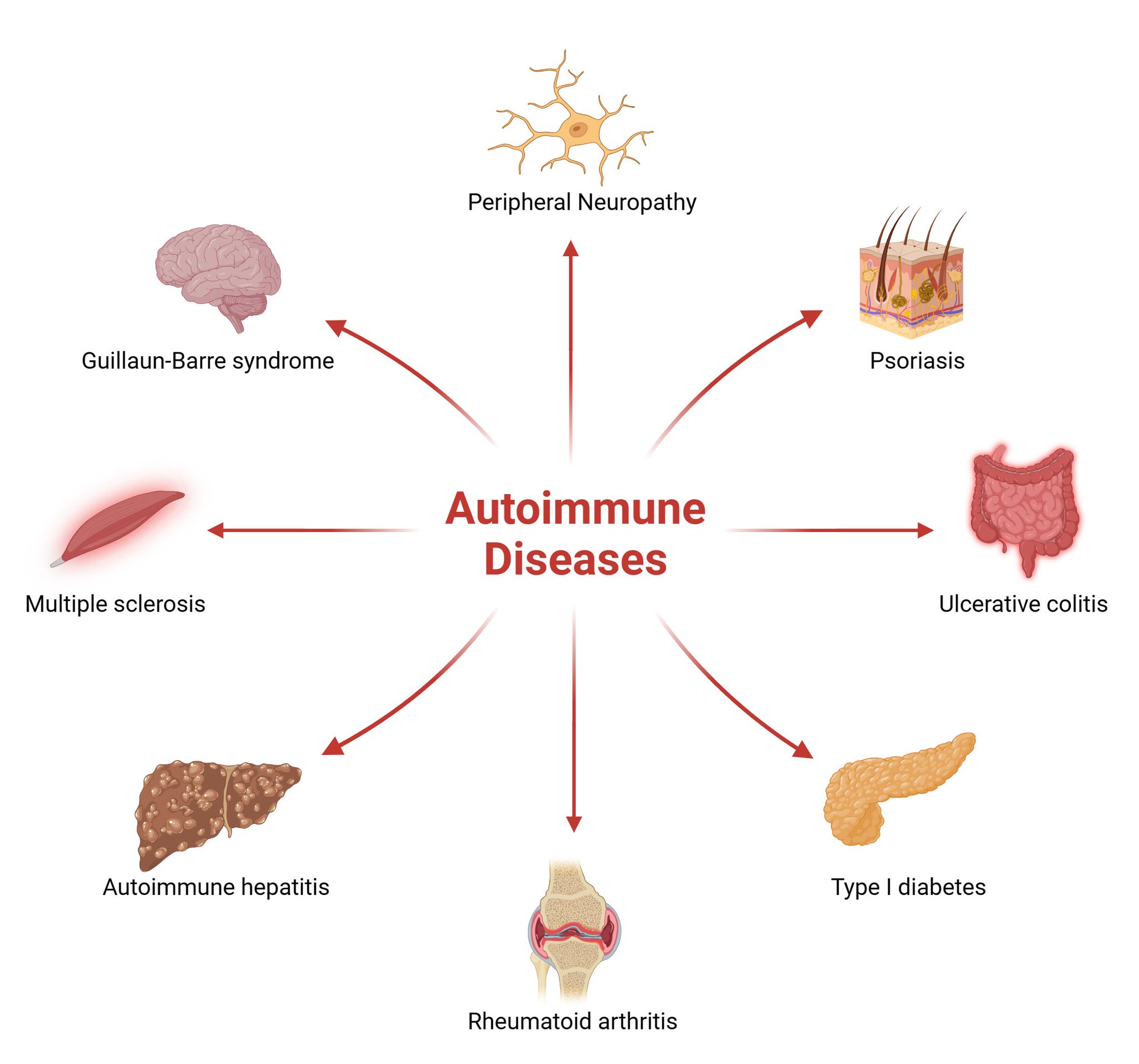 Overview of 10 key causes of autoimmune disease
