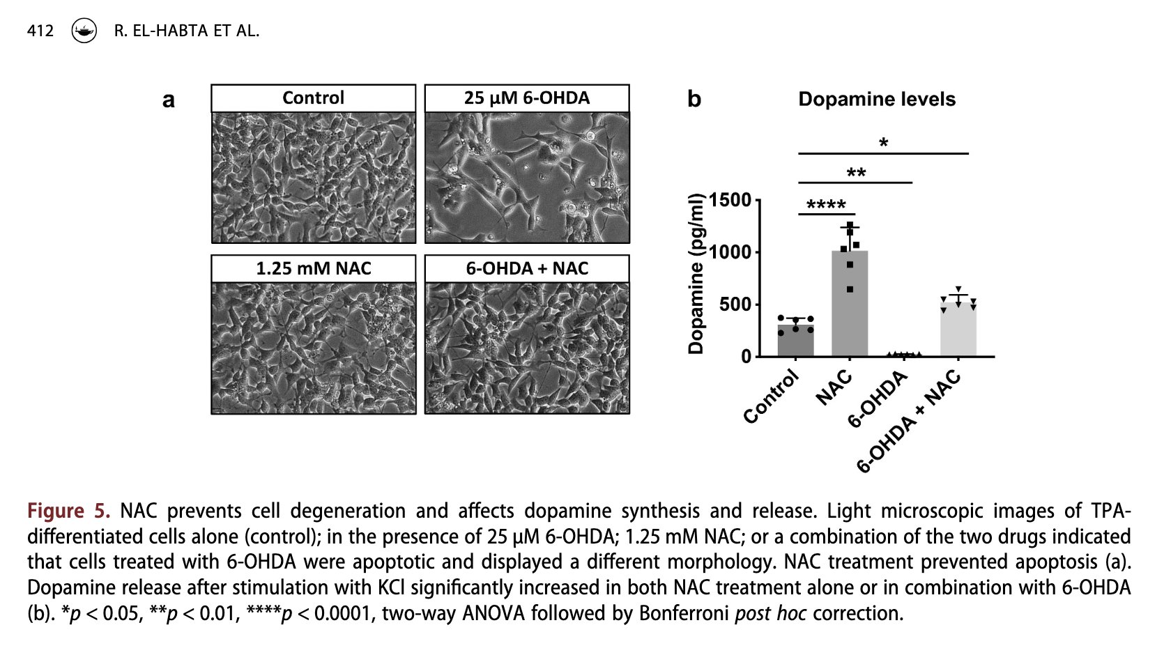 Study results showing N-acetylcysteine doubling dopamine levels