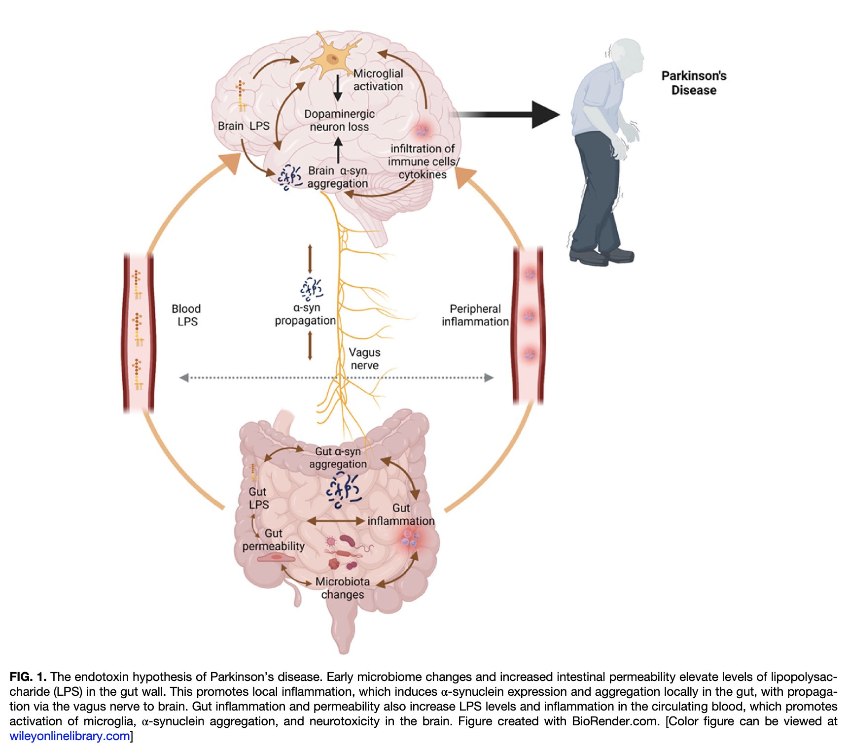Diagram of gut endotoxin and inflammation suppressing dopamine synthesis