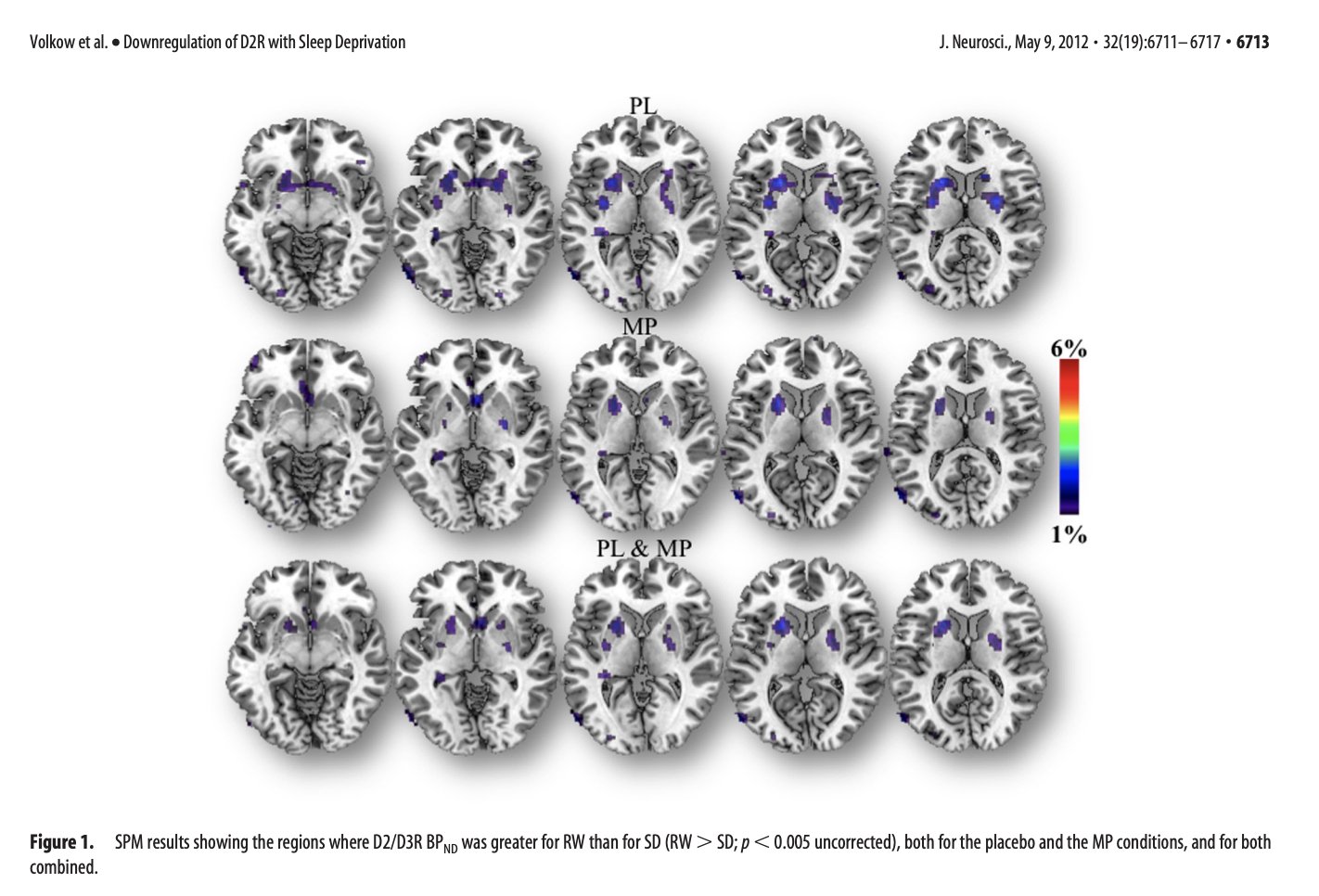 Study showing sleep deprivation reducing dopamine receptors in the brain