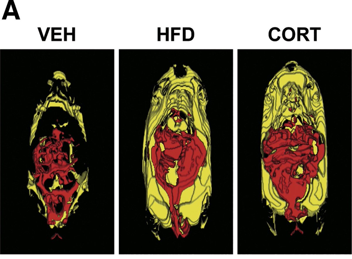 High cortisol linked to belly fat gain and overeating