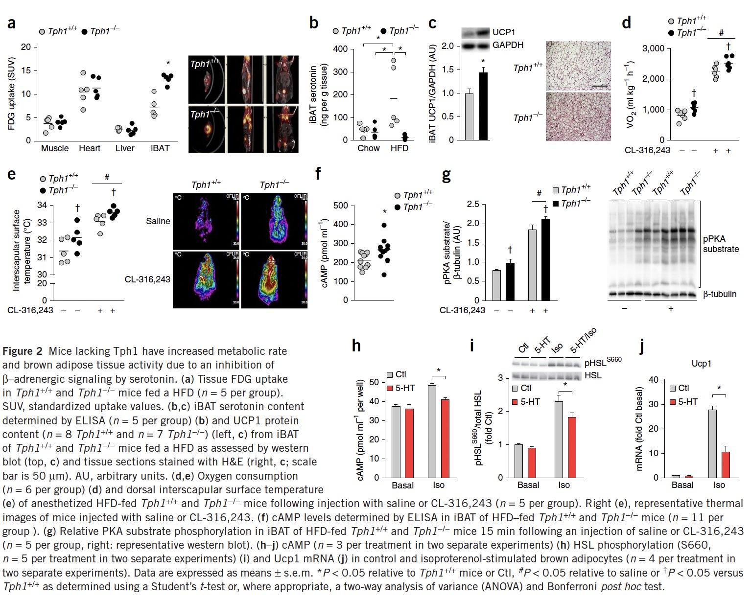 Research linking serotonin to insulin resistance