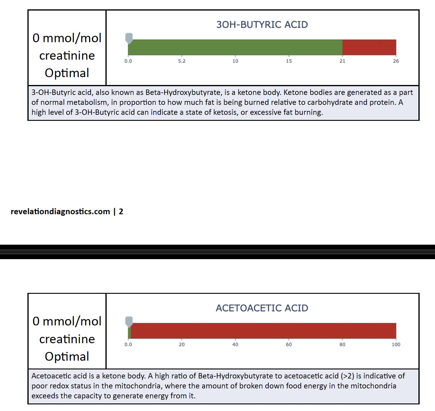 Urinary ketone results showing no ketones detected