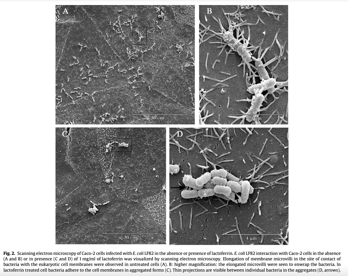 Lactoferrin starving E. coli of iron while Lactobacillus and Bifidobacterium thrive