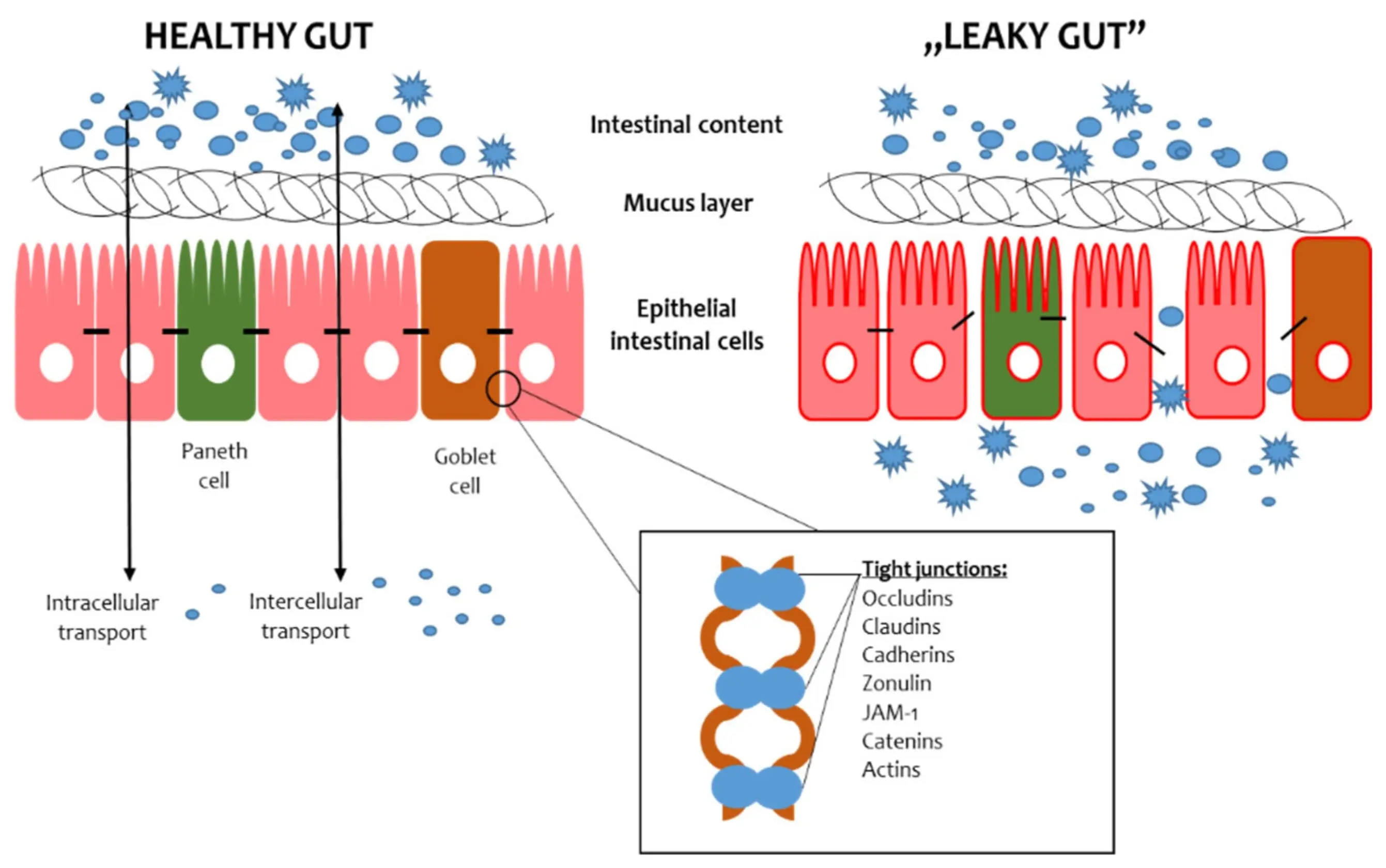 Common leaky gut symptoms including bloating, food intolerances, skin flare-ups and poor sleep