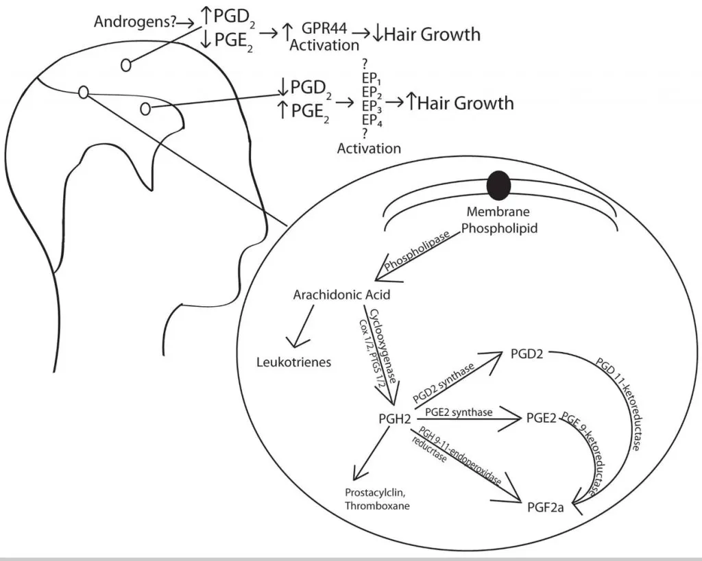 Diagram showing how prostaglandin D2 halts the hair growth cycle in androgenetic alopecia