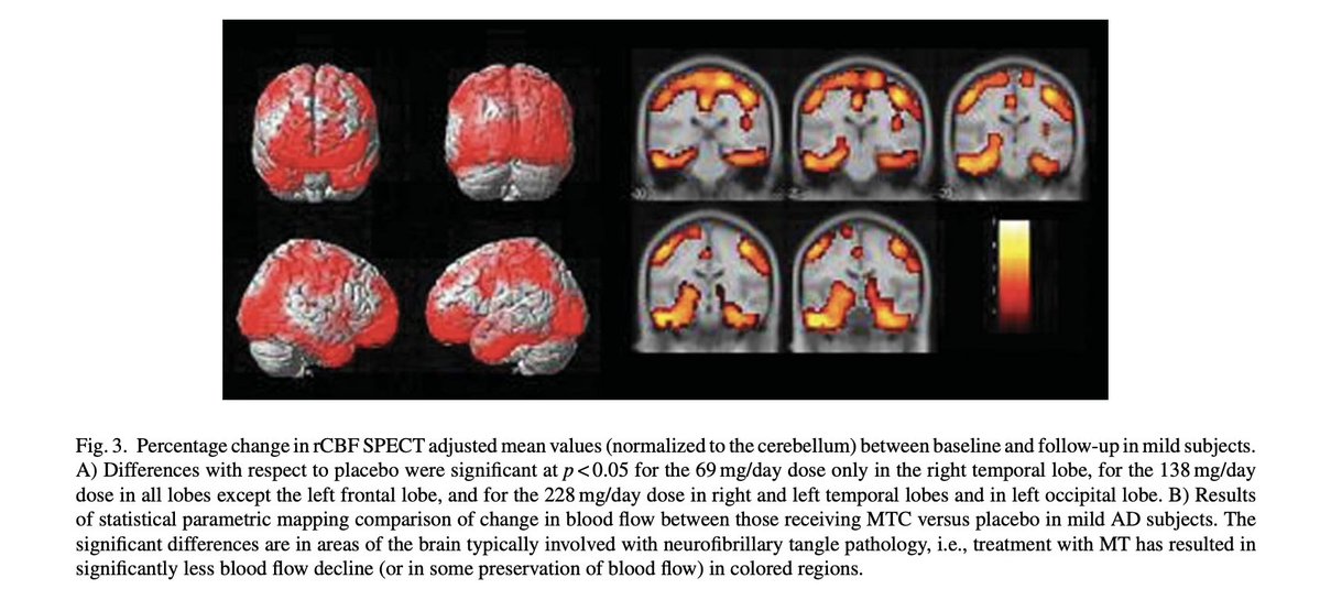 Study on methylene blue improving cerebral blood flow and cognitive function