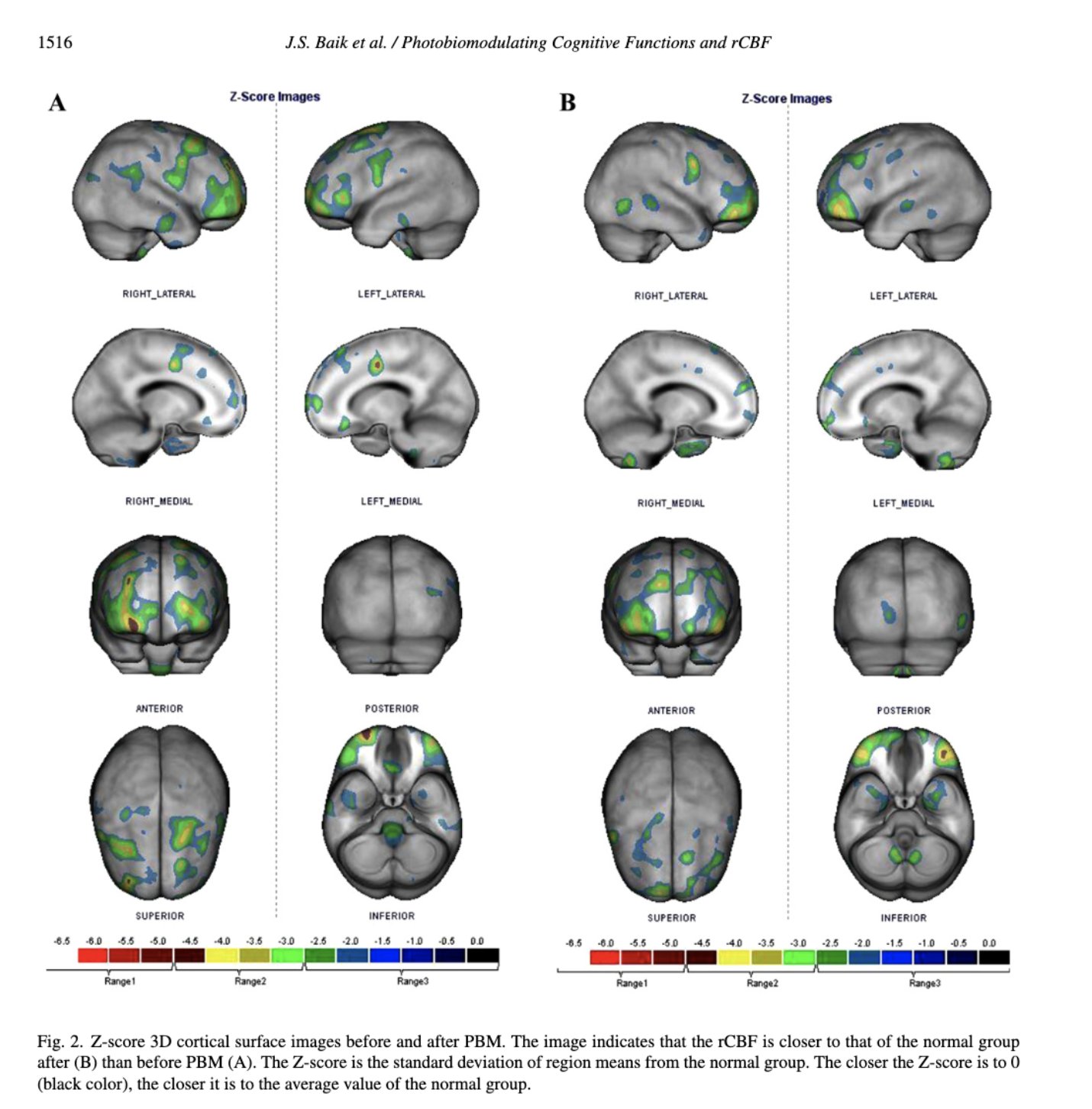Illustration of red light therapy stimulating cerebral blood flow for cognitive health