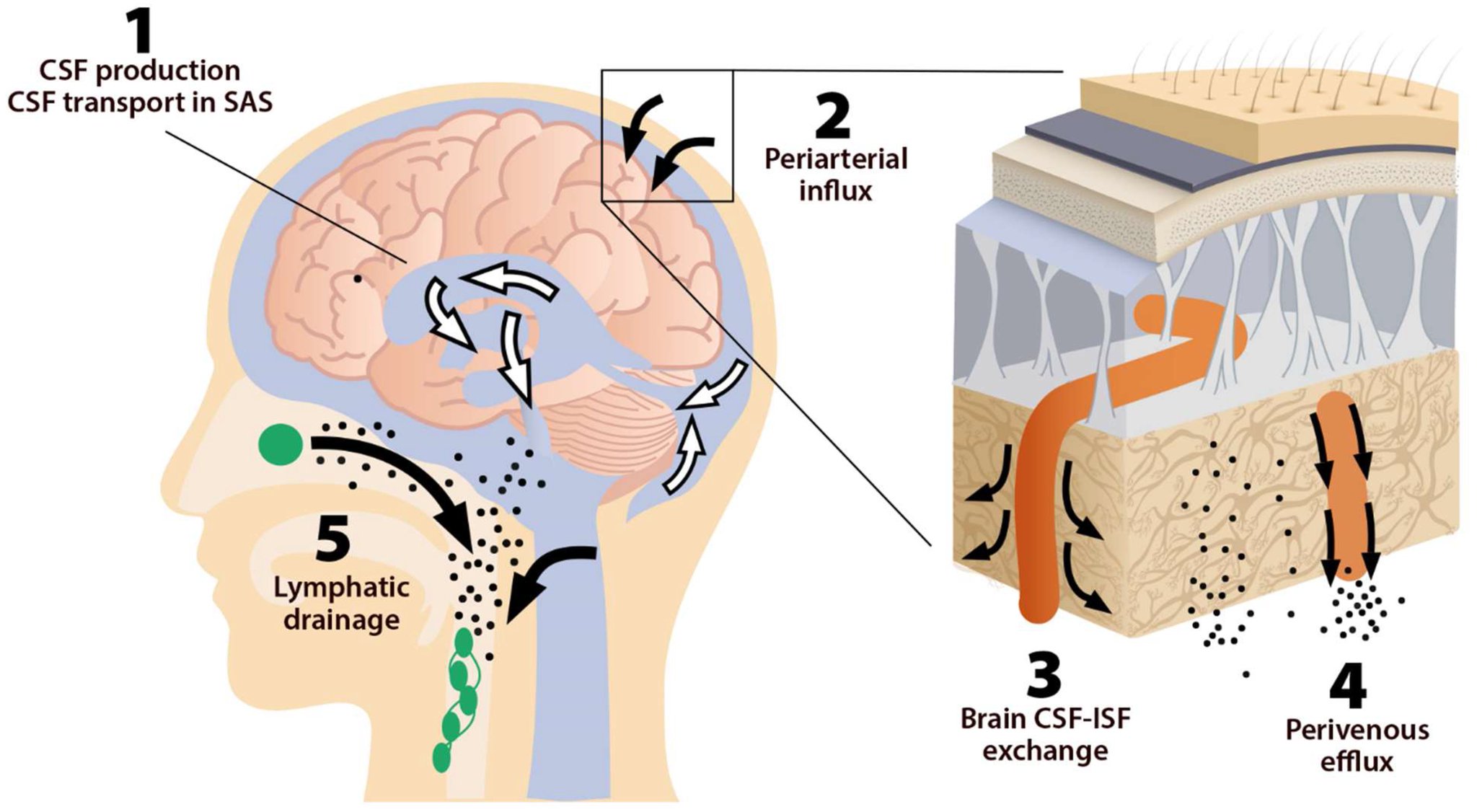 Diagram of the glymphatic system clearing brain waste and its impairment in chronic fatigue